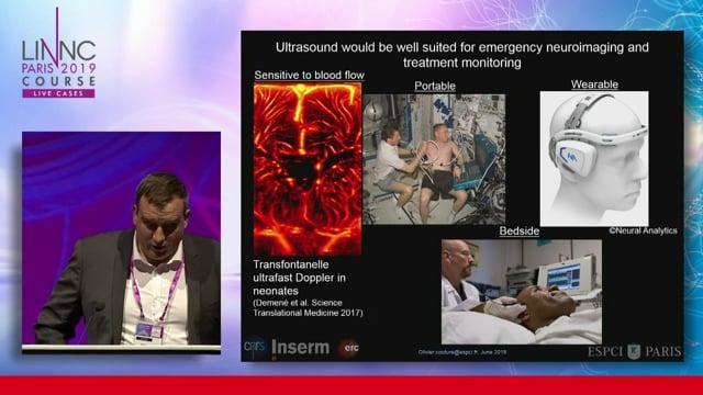 Ultrasound localization microscopy of the brain