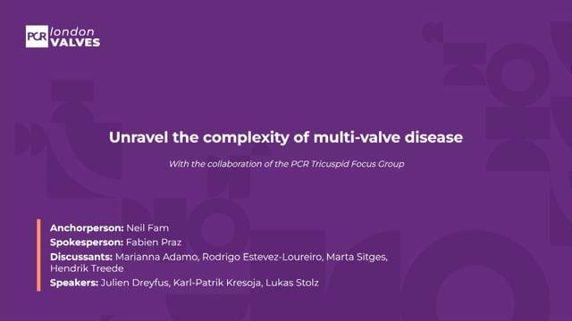 Unravel the complexity