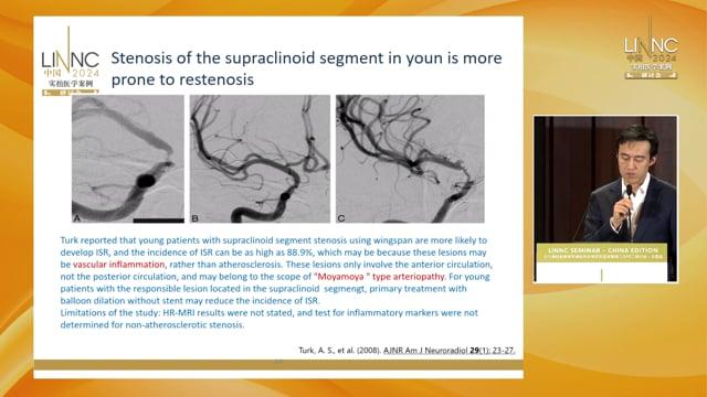 Recurrent restenosis of multiple intracranial stenosis: a case report