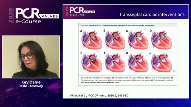 Learning transseptal