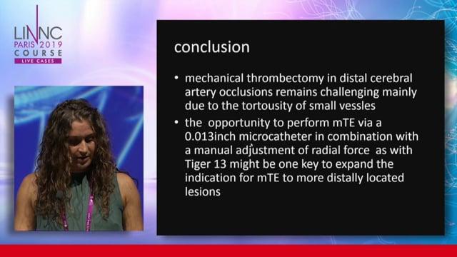 Mechanical Thrombectomy in distal MCA occlusion using Tiger 13