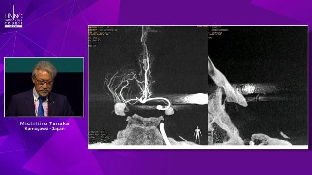 Micro-neuroangiography of the Anterior Communicating Artery Complex and Its Perforators