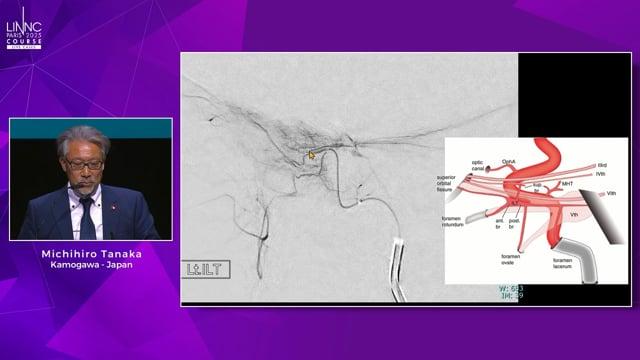 Analysis Of Dural Membrane Ultrastructure With High-Resolution Cone Beam CT