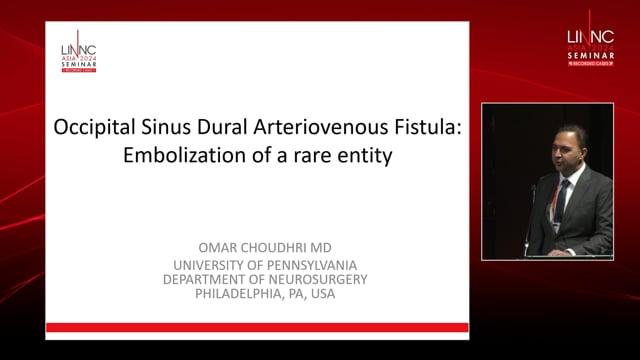 Occipital Sinus Dural Arteriovenous Fistula: Embolization of a rare entity