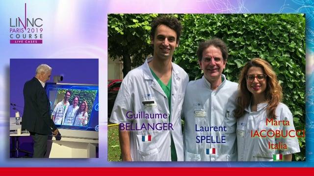 A complex treatment: a venous approach to embolization of a deep AVM