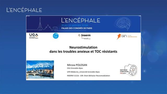 Neurostimulation dans les troubles anxieux et TOC résistants