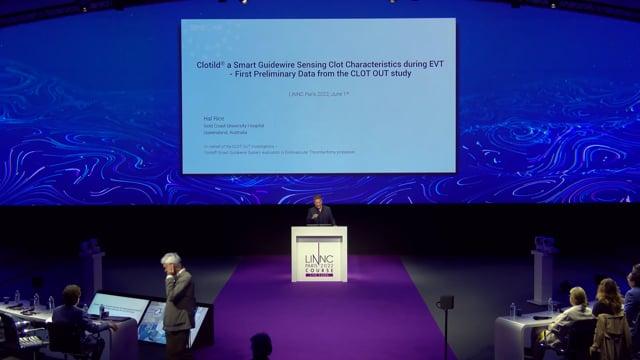 Clotild a Smart guidewire sensing clot characteristics during EVT:  First preliminary data from the CLOT OUT study