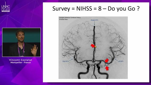 MeVO and distal occlusions: where do we stand after the trial avalanche?