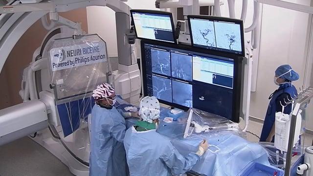 Successful recanalization of an ACA occlusion