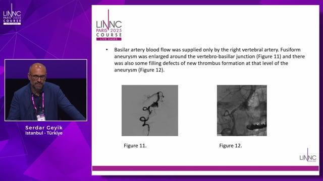 Basilar Fusiform Aneurysm With Occluded Flow Diverter Stent: What Can We Do?