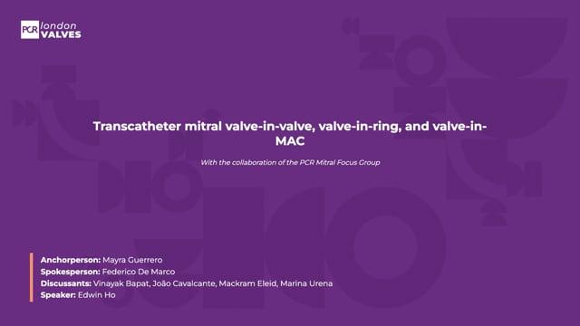 Transcatheter mitral