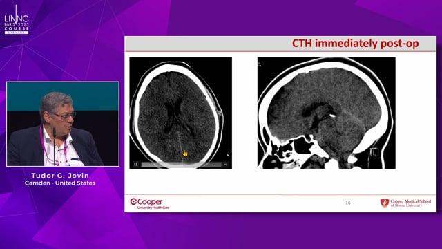 Complications in venous Stenting