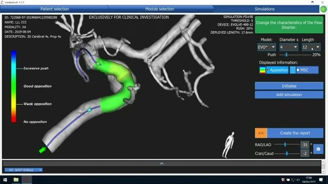 Live Cases Transmission Paris, France Bicêtre University Hospital