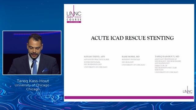 Acute ICAD rescue stenting