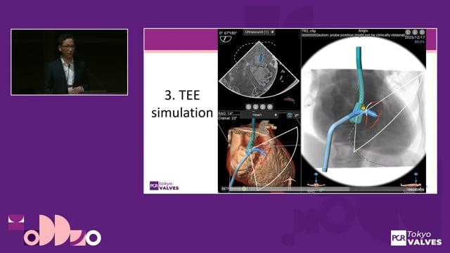 Mastering techniques