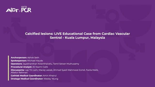 Calcified lesions: LIVE