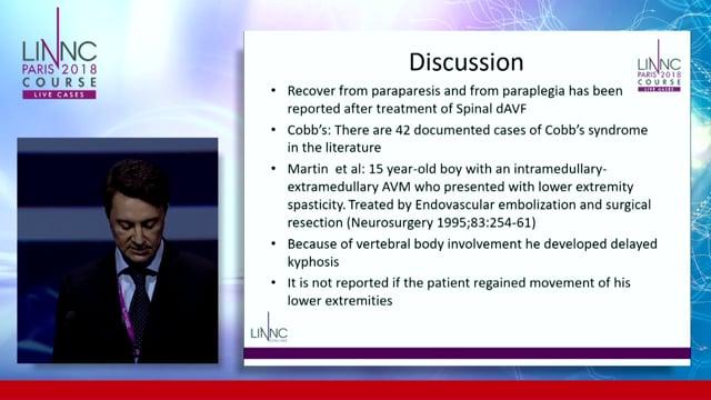 Metameric spinal arteriovenous malformation