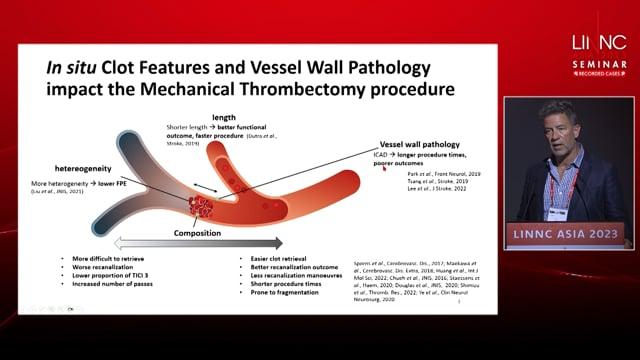 Clotild guide and prediction algorithm uses machine detector to analyse clot