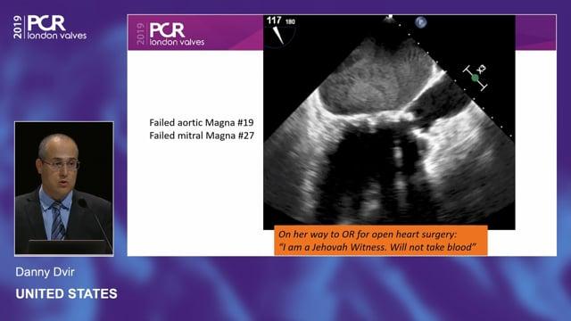PCR London Valves 2019