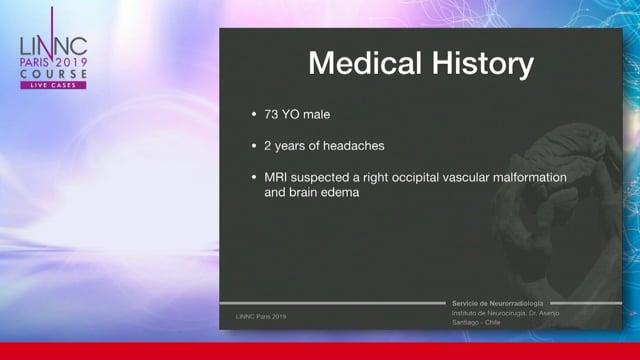 Live Cases Transmission Santiago de Chile, Chile - Instituto de Neurocirugia Dr Asenjo