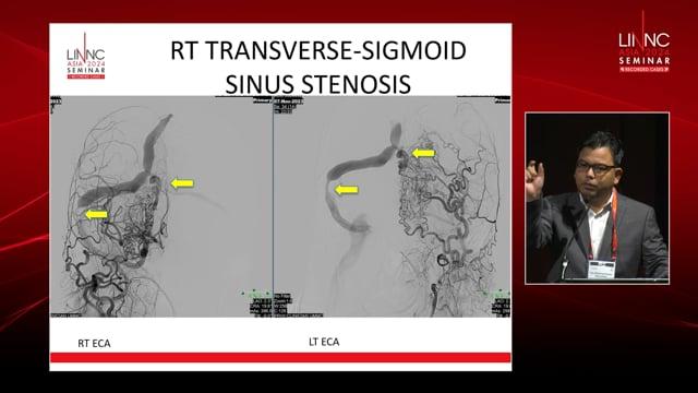 Cognitive impairment in venous hypertension