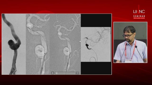 Medicine is a Science of Uncertainty & an Art of Probability : Sir William Osler