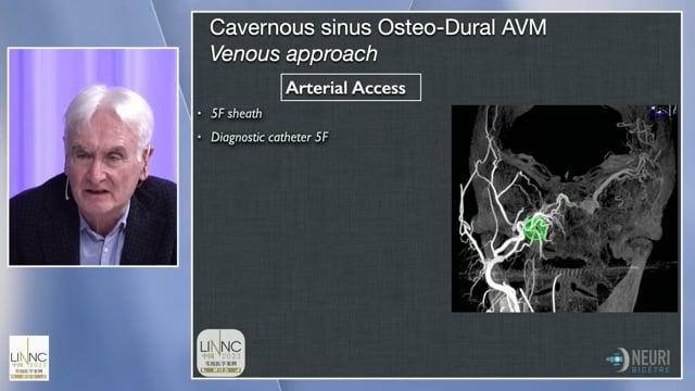I am an osteodural vascular malformation: what does that mean? How do you treat me?