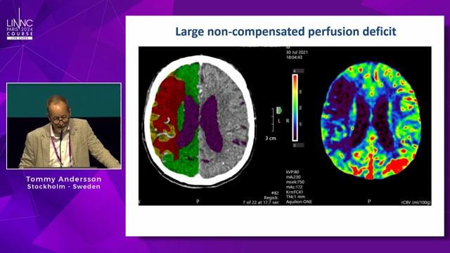 Stroke imaging today: When, where and what?