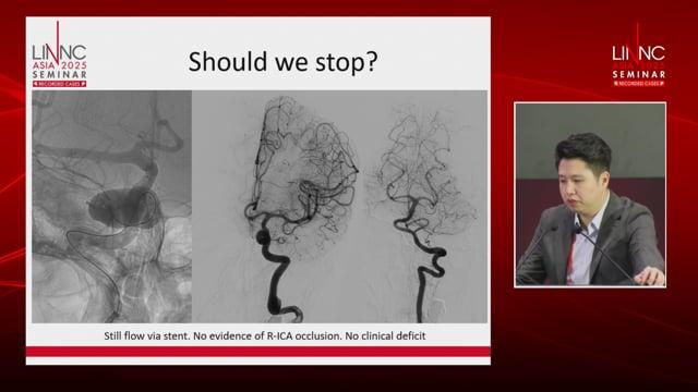 How to face up with an un-opened device in deploying Flow-diverter